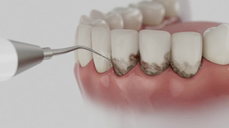 Reliable Dental Implants contractor in Brock Hall, MD by Smile Center Dentistry